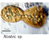 Nostoc Sp. Nostoc Sp.